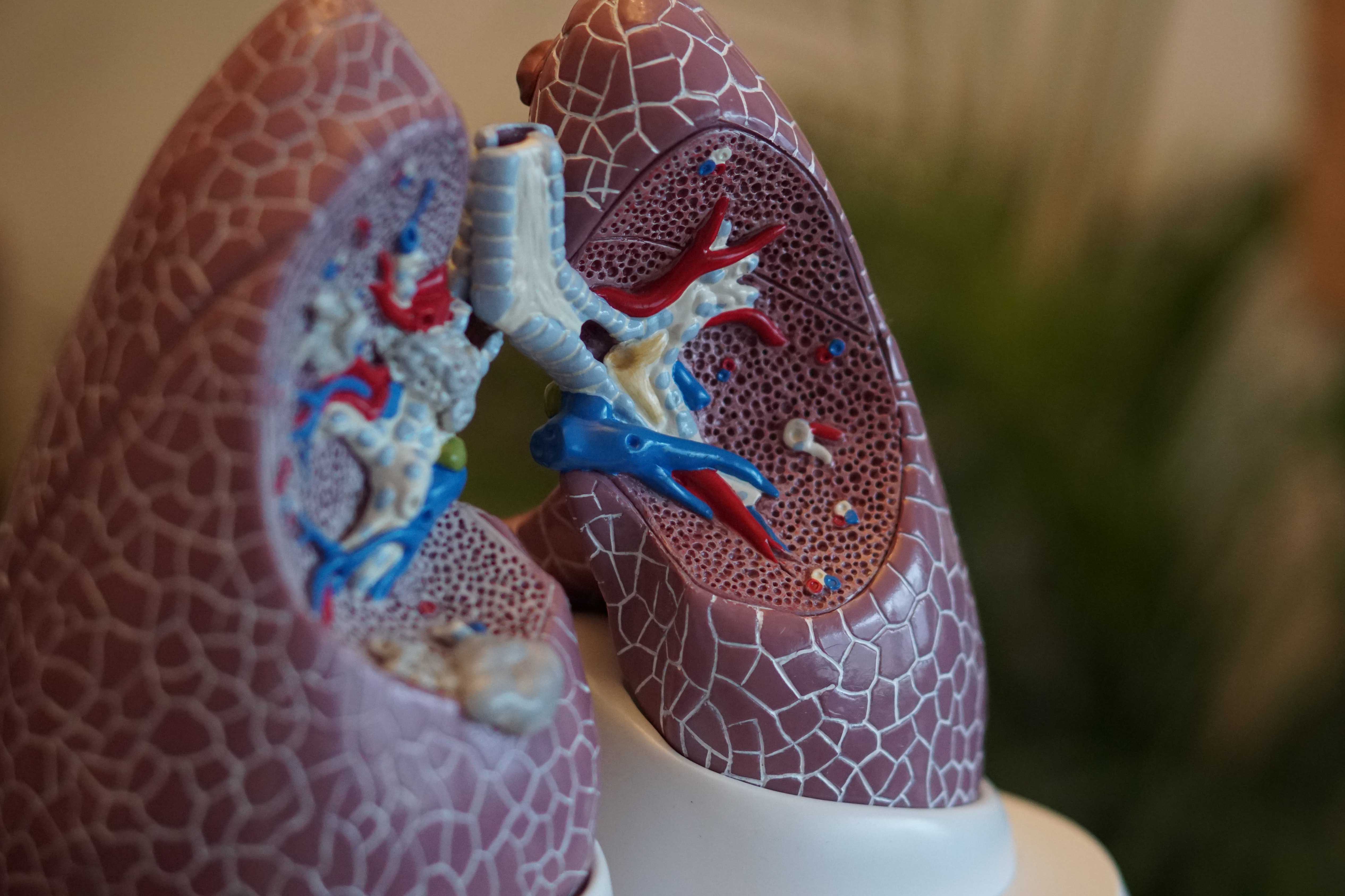 Lung Cancer Blog